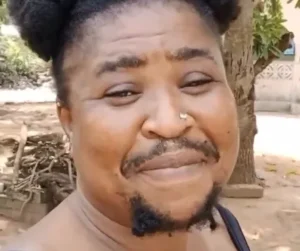“People Ask If I’m a Man or Woman” — Ghanaian Woman With Hirsutism Speaks Out